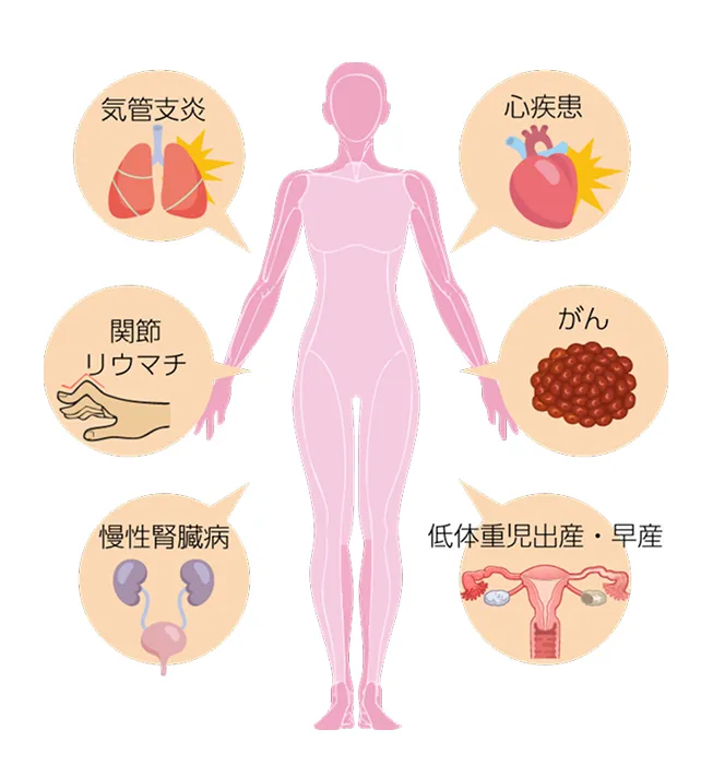 その他の全身と歯周病の関係