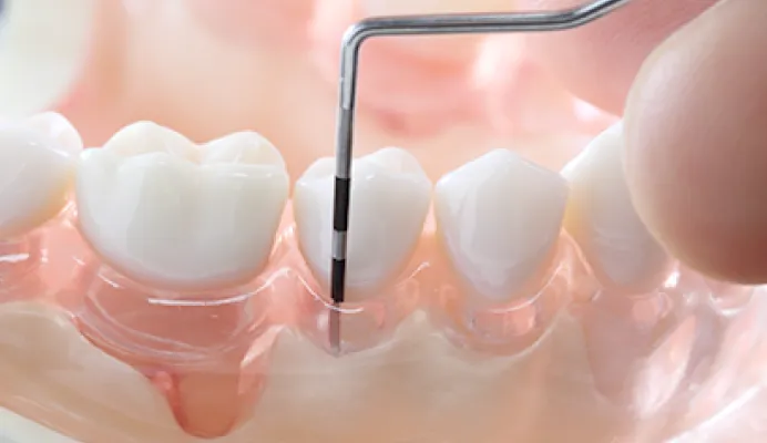 プロービング検査